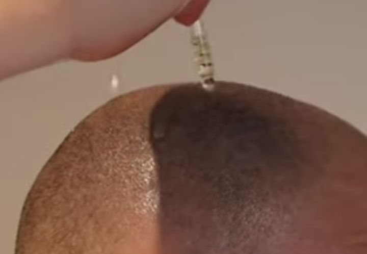 Applying the head shaving oil to ensure it freshens and moisturizes the scalp skin